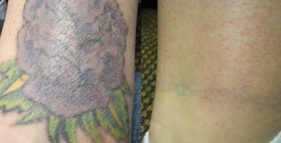 مرکز تخصصی پوست و لیزر سیما طب