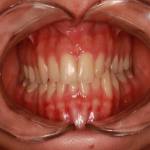 فتوگرافی پزشکی تخصصی پرتو قزوین