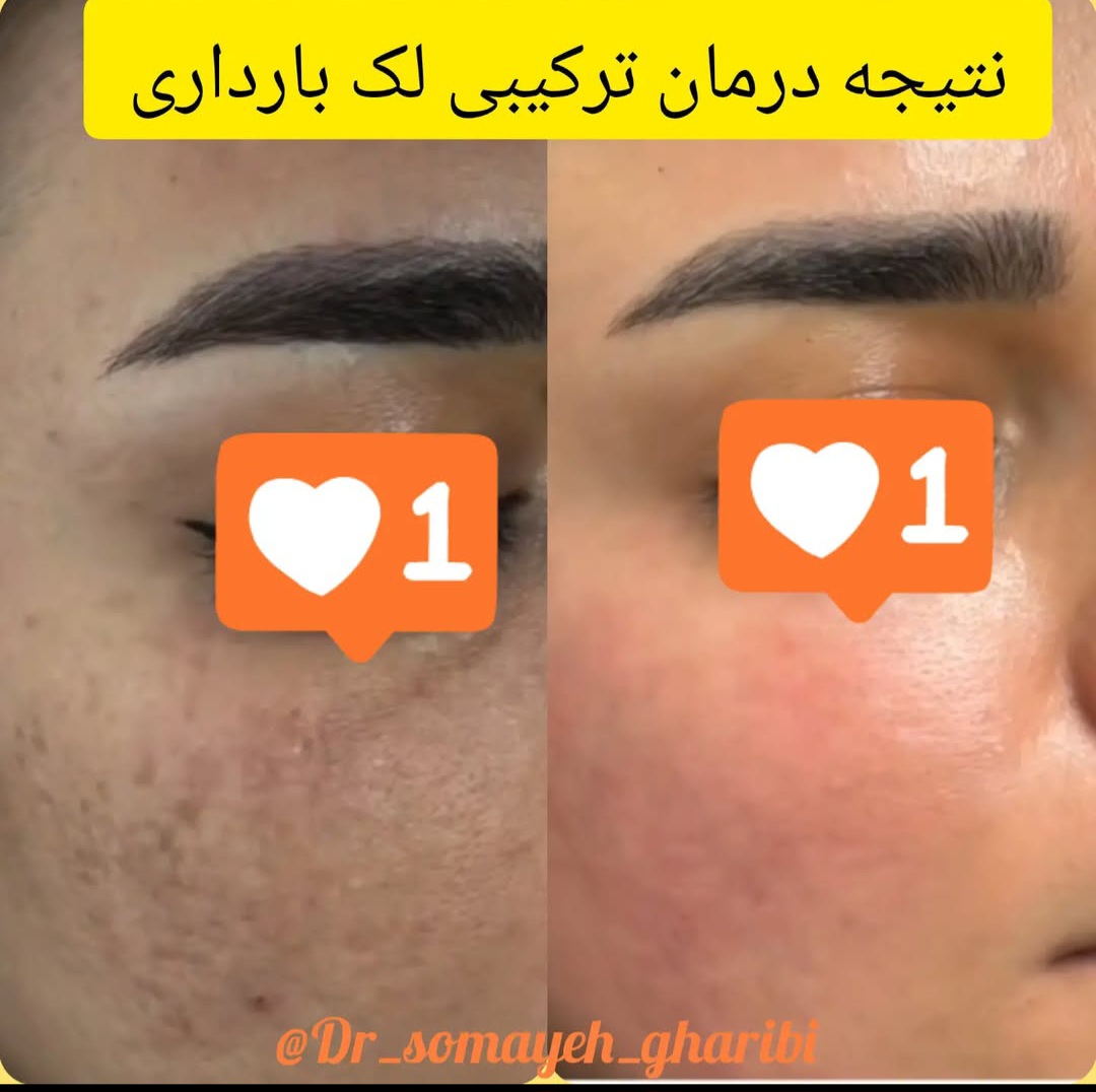 اضافه شده توسط  فرزانه