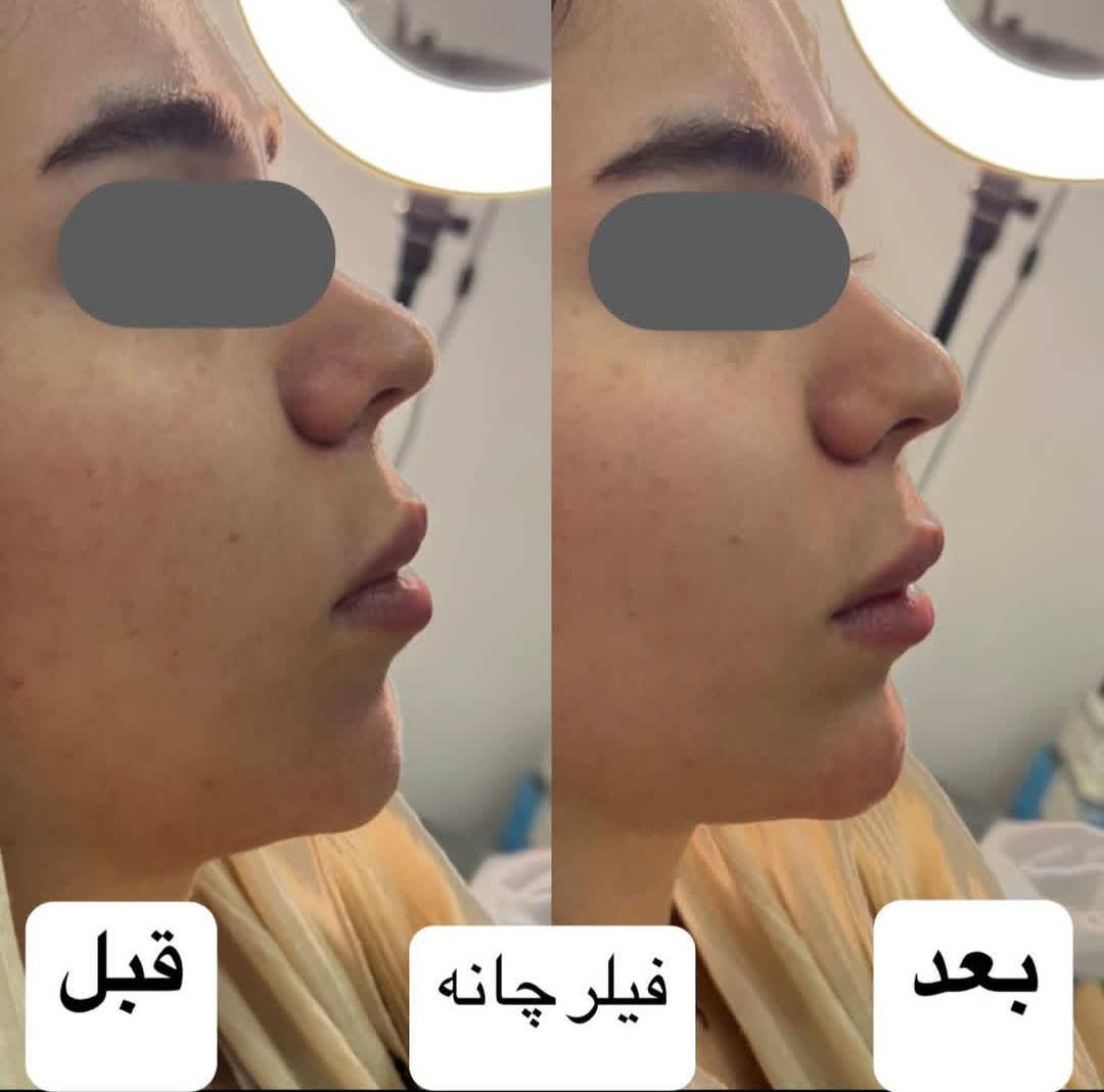 اضافه شده توسط  فرزانه