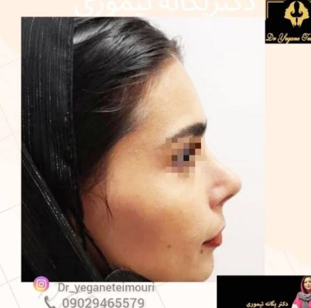 دکتر یگانه تیموری