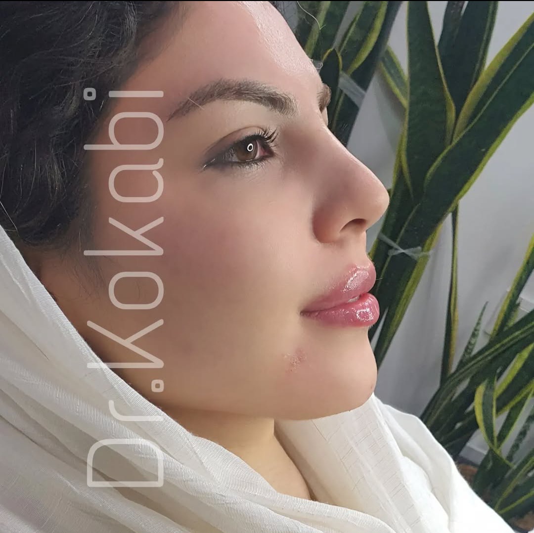 اضافه شده توسط  فرزانه