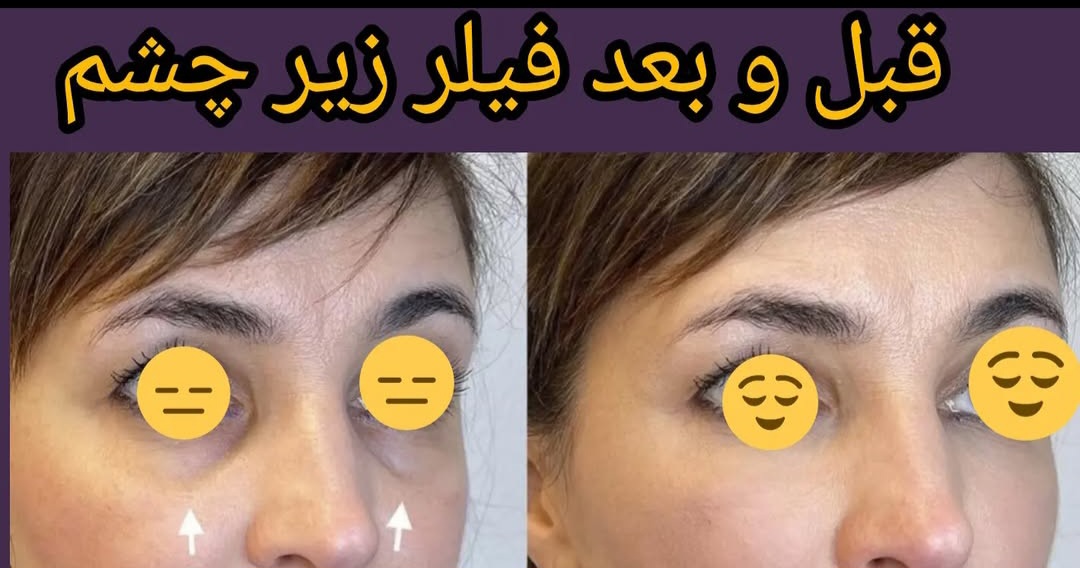 اضافه شده توسط  فرزانه