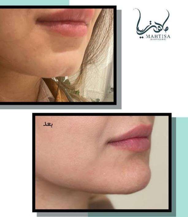 مجتمع پزشکی ماهتیسا
