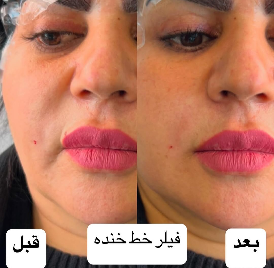 اضافه شده توسط  فرزانه