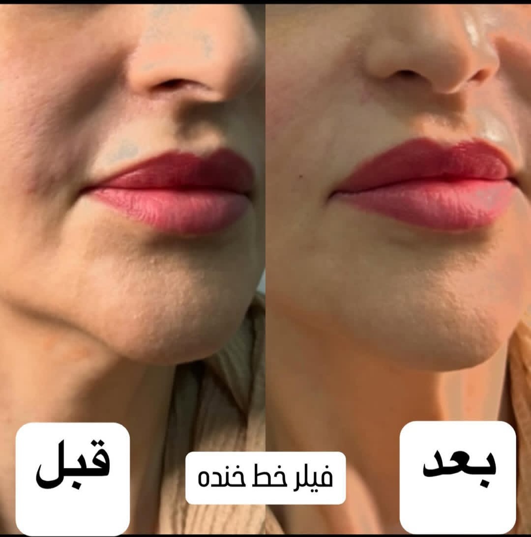 اضافه شده توسط  فرزانه