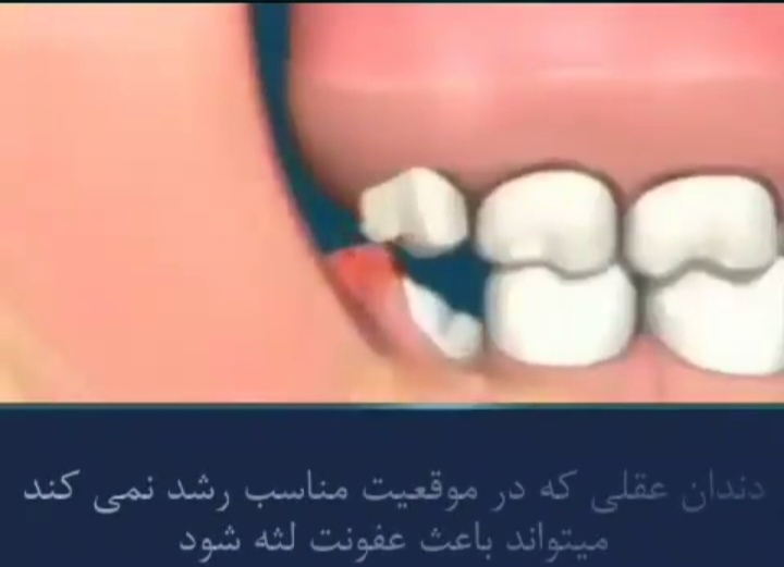 اضافه شده توسط <br> امیر