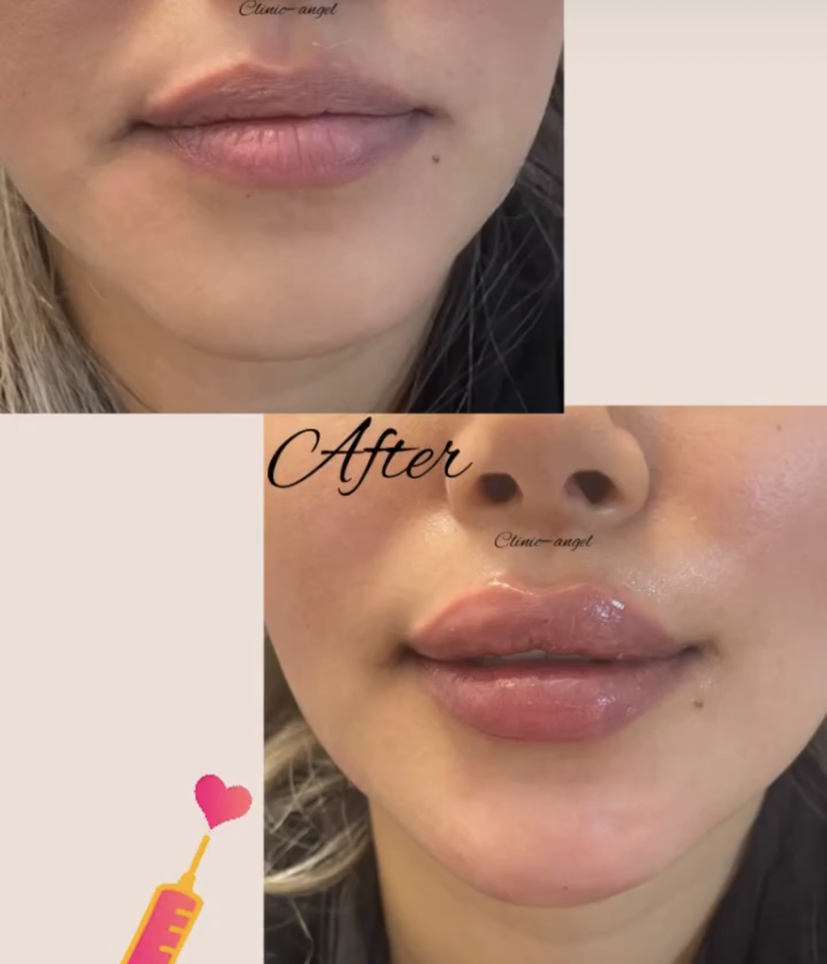 خدمات زیبایی آنجل