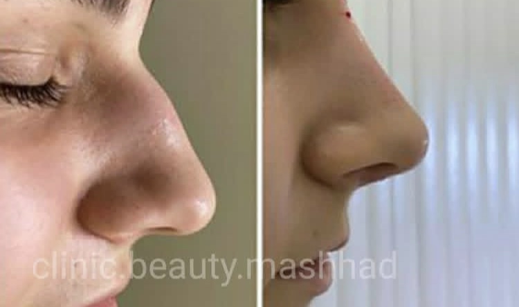 کلینیک زیبایی الماس بیوتی