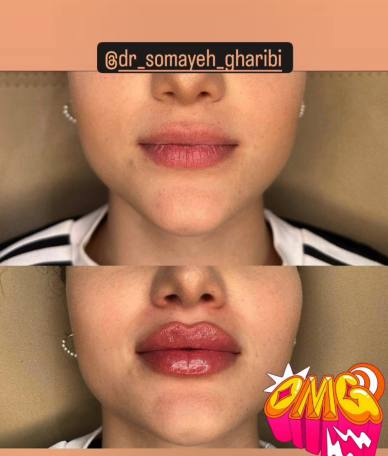 اضافه شده توسط  فرزانه