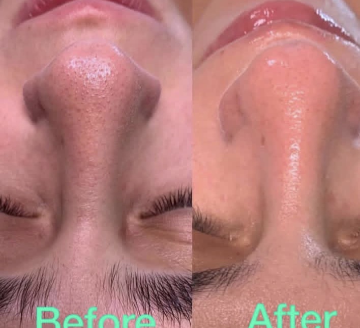 خدمات پوست و مو ثمانه هاشمی