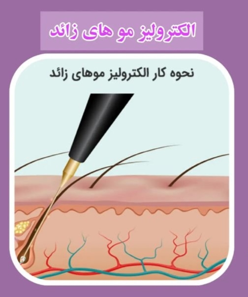 اضافه شده توسط <br> امیر