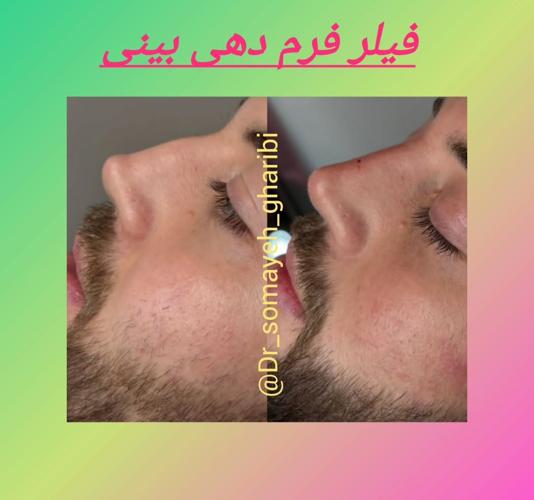 اضافه شده توسط  فرزانه
