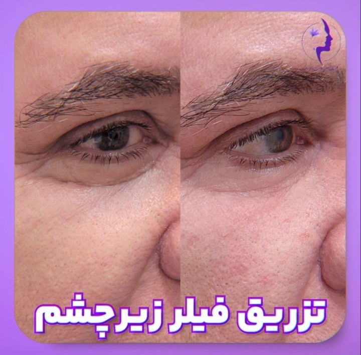 اضافه شده توسط <br> امیر