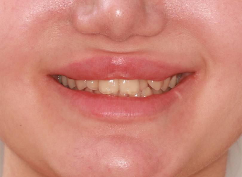 فتوگرافی پزشکی تخصصی پرتو قزوین