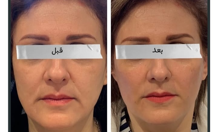 مجتمع پزشکی ماهتیسا