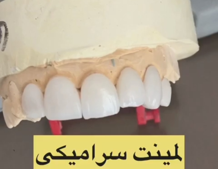 اضافه شده توسط <br> امیر