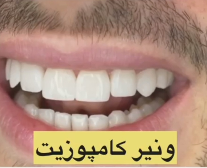 اضافه شده توسط <br> امیر