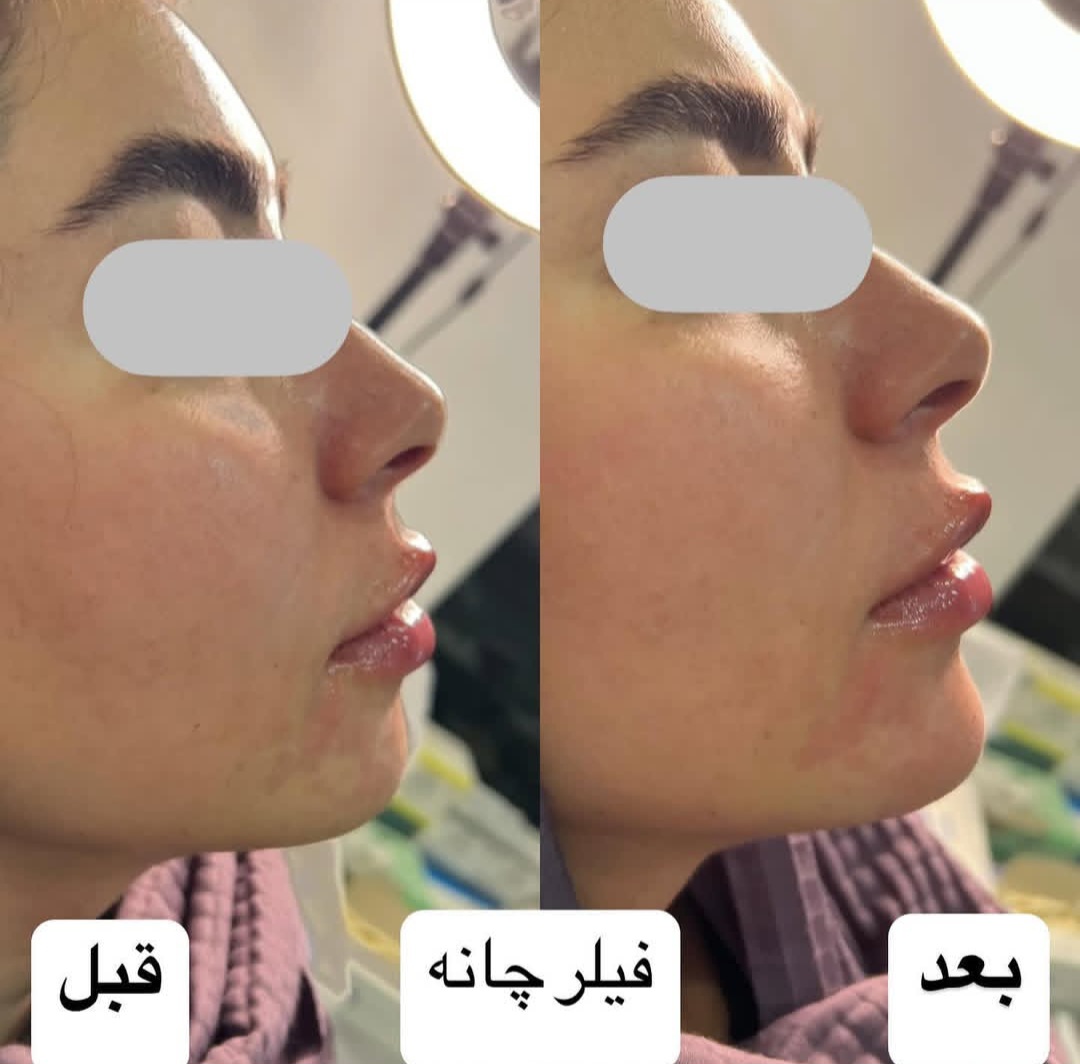 اضافه شده توسط  فرزانه