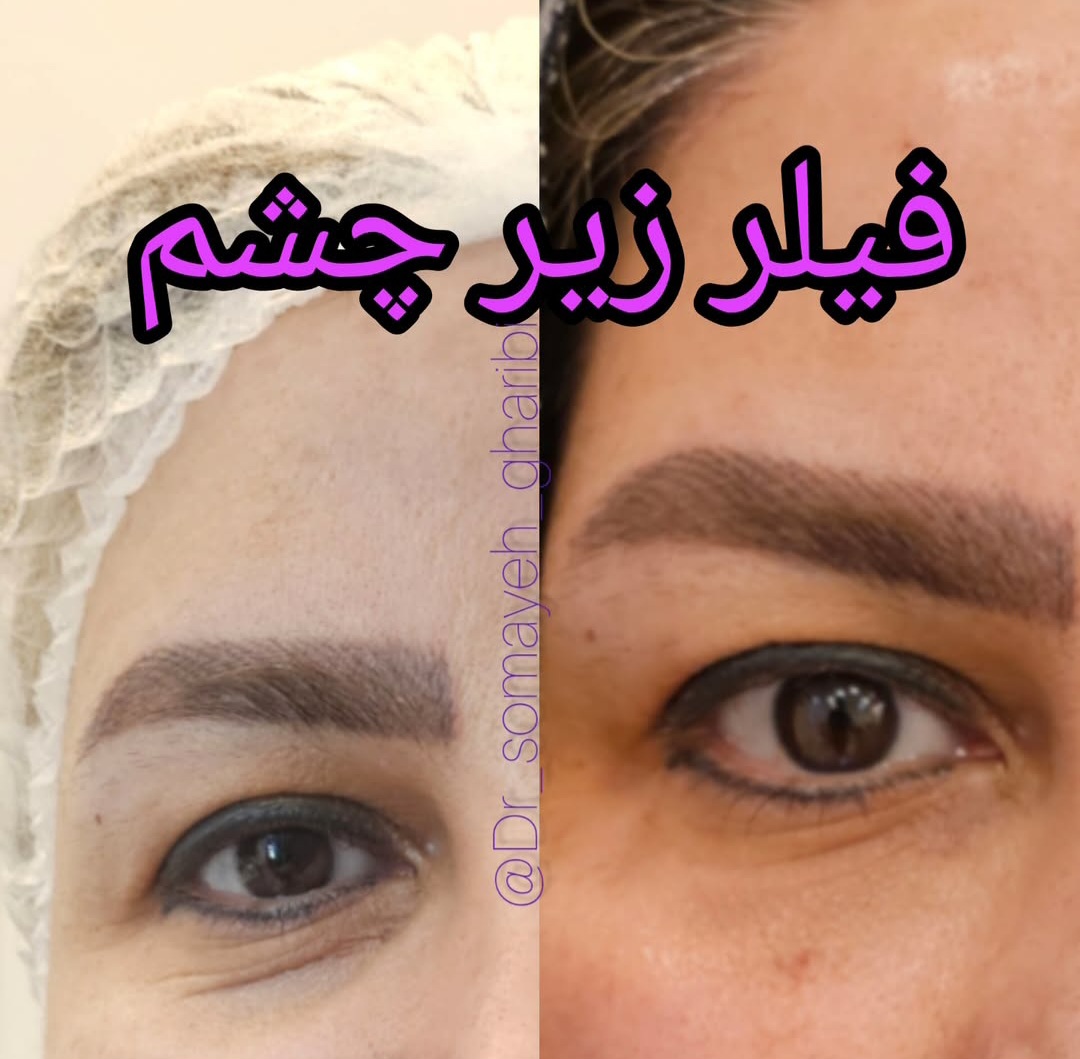 اضافه شده توسط  فرزانه