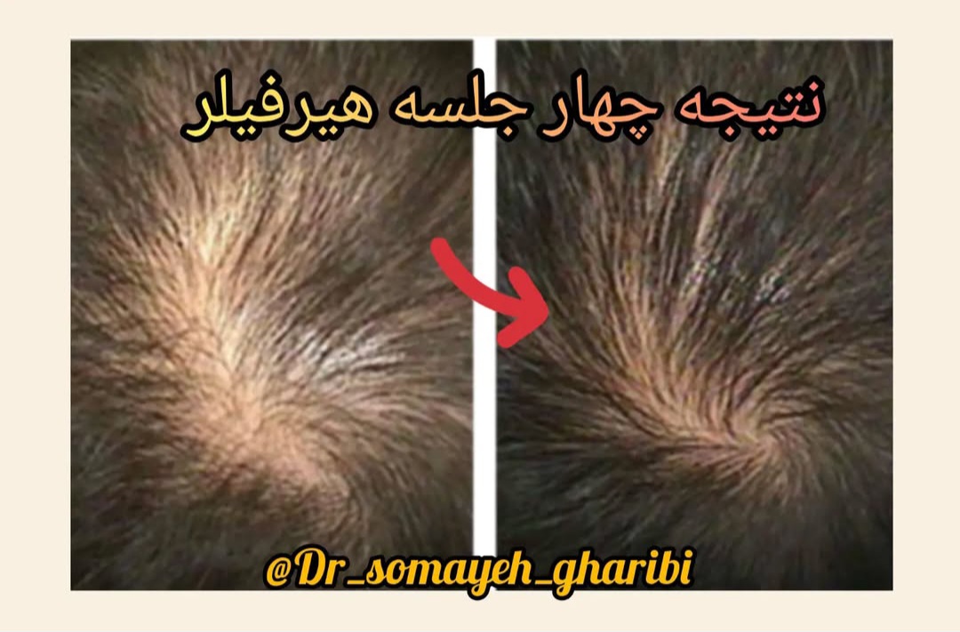اضافه شده توسط  فرزانه