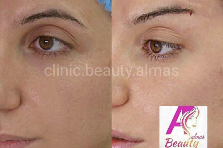 کلینیک زیبایی الماس بیوتی