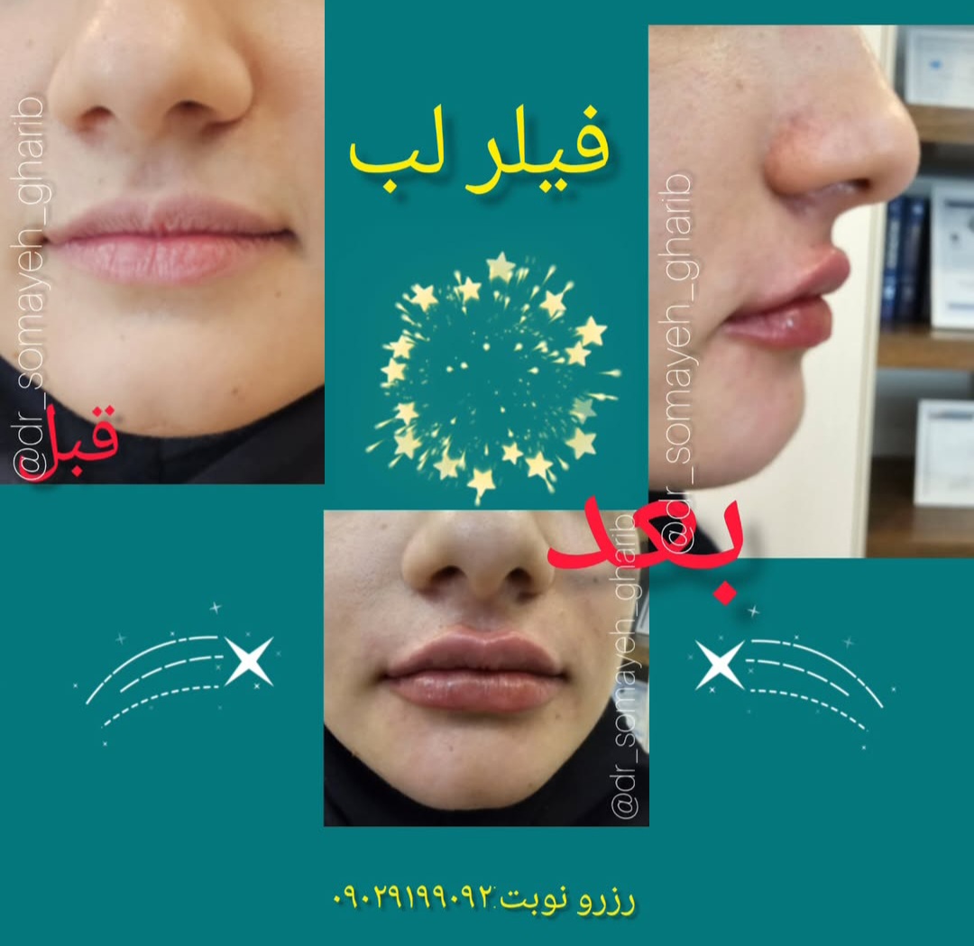 اضافه شده توسط  فرزانه