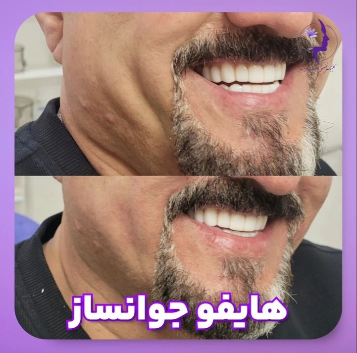 اضافه شده توسط <br> امیر