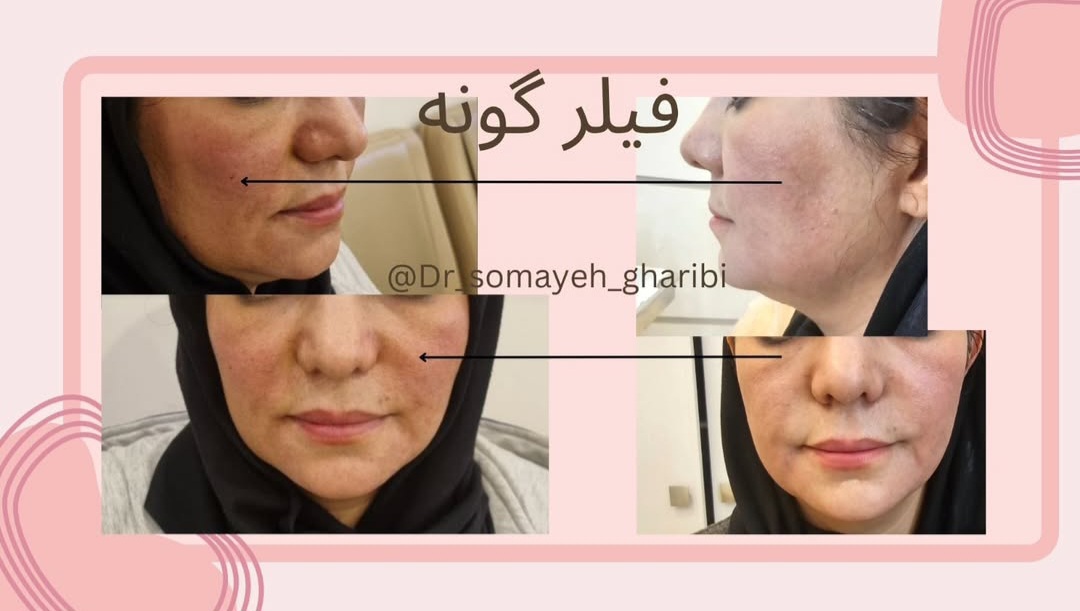اضافه شده توسط  فرزانه