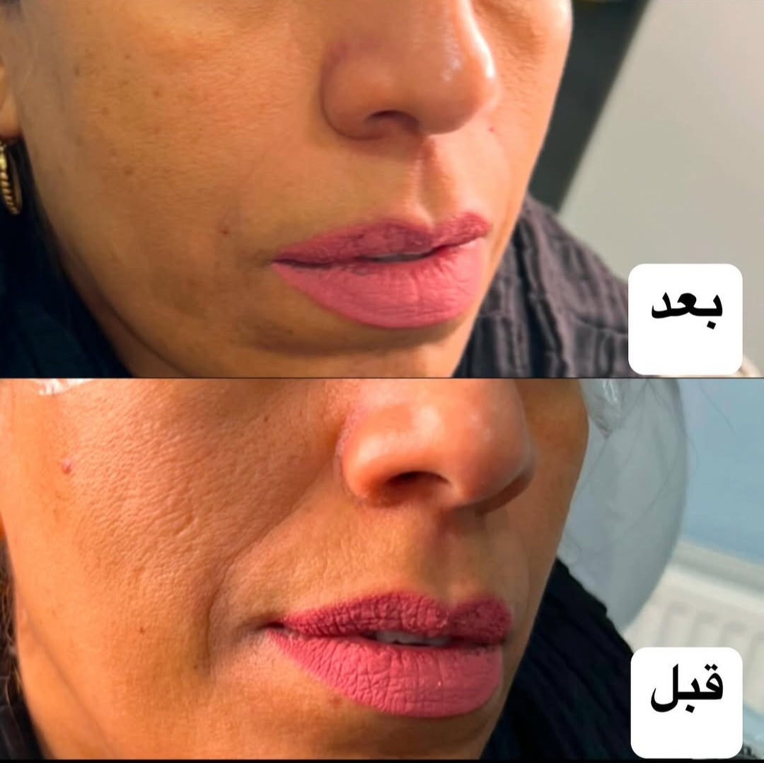 اضافه شده توسط  فرزانه