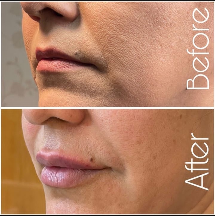 اوریکولوتراپی دکتر الماسی