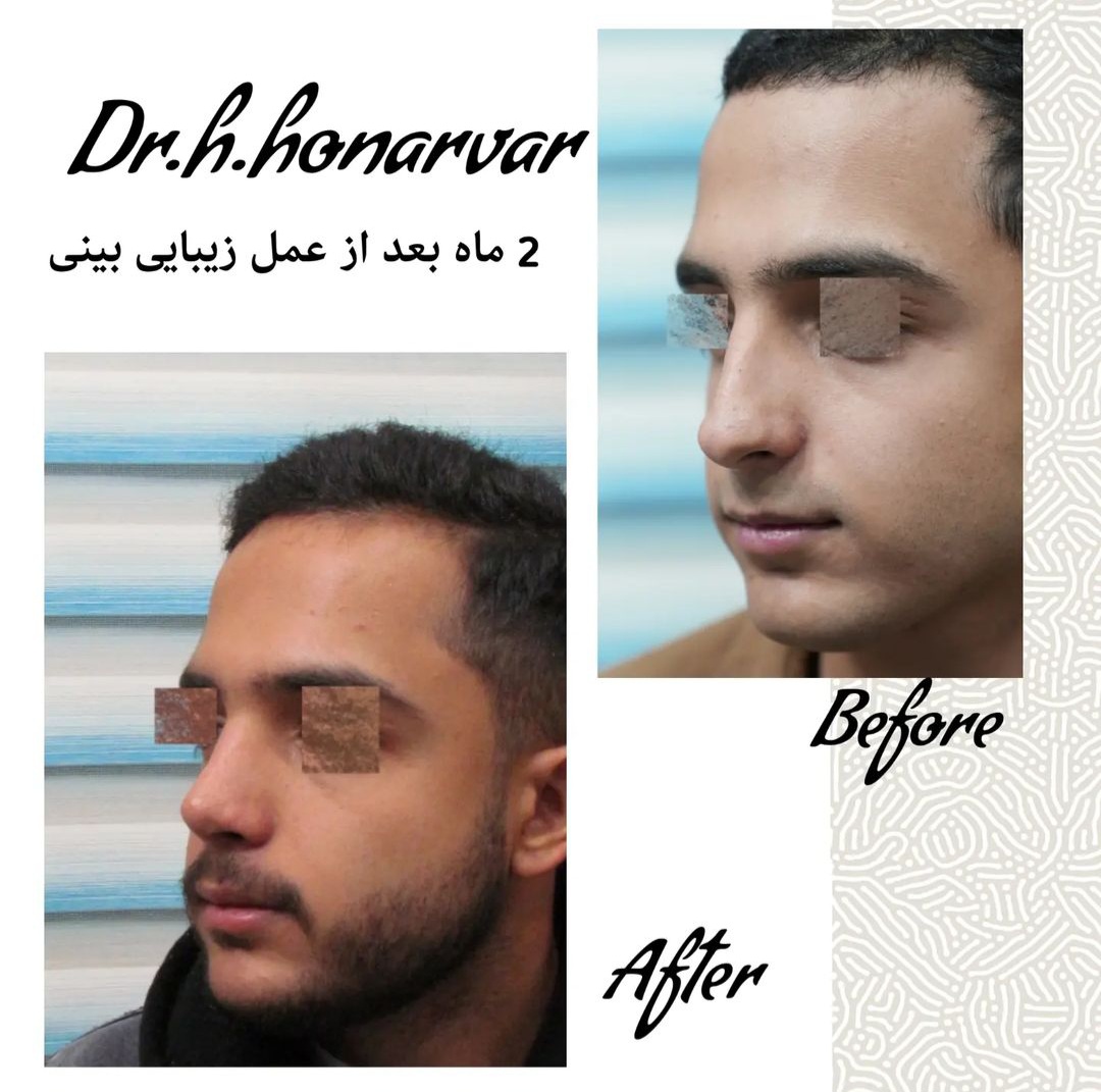 دکتر حسن هنرور