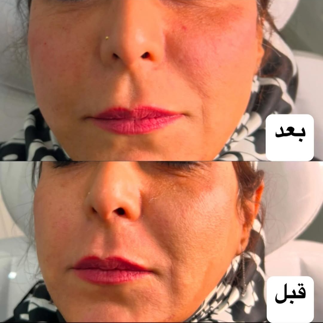 اضافه شده توسط  فرزانه