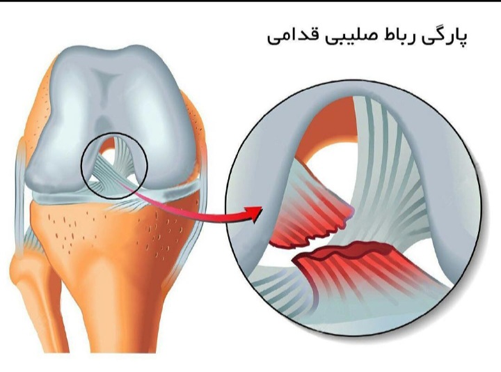 دکتر مسعود آیتی