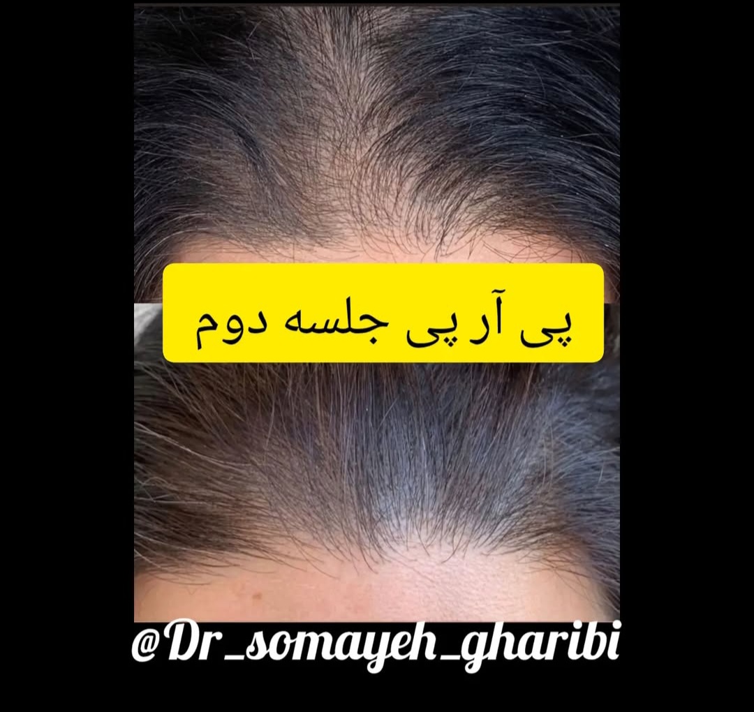 اضافه شده توسط  فرزانه