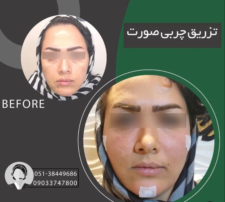 کلینیک تخصصی پوست و مو دنیز