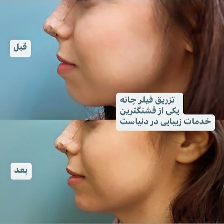 کلینیک زیبایی پوست و مو پارادایس