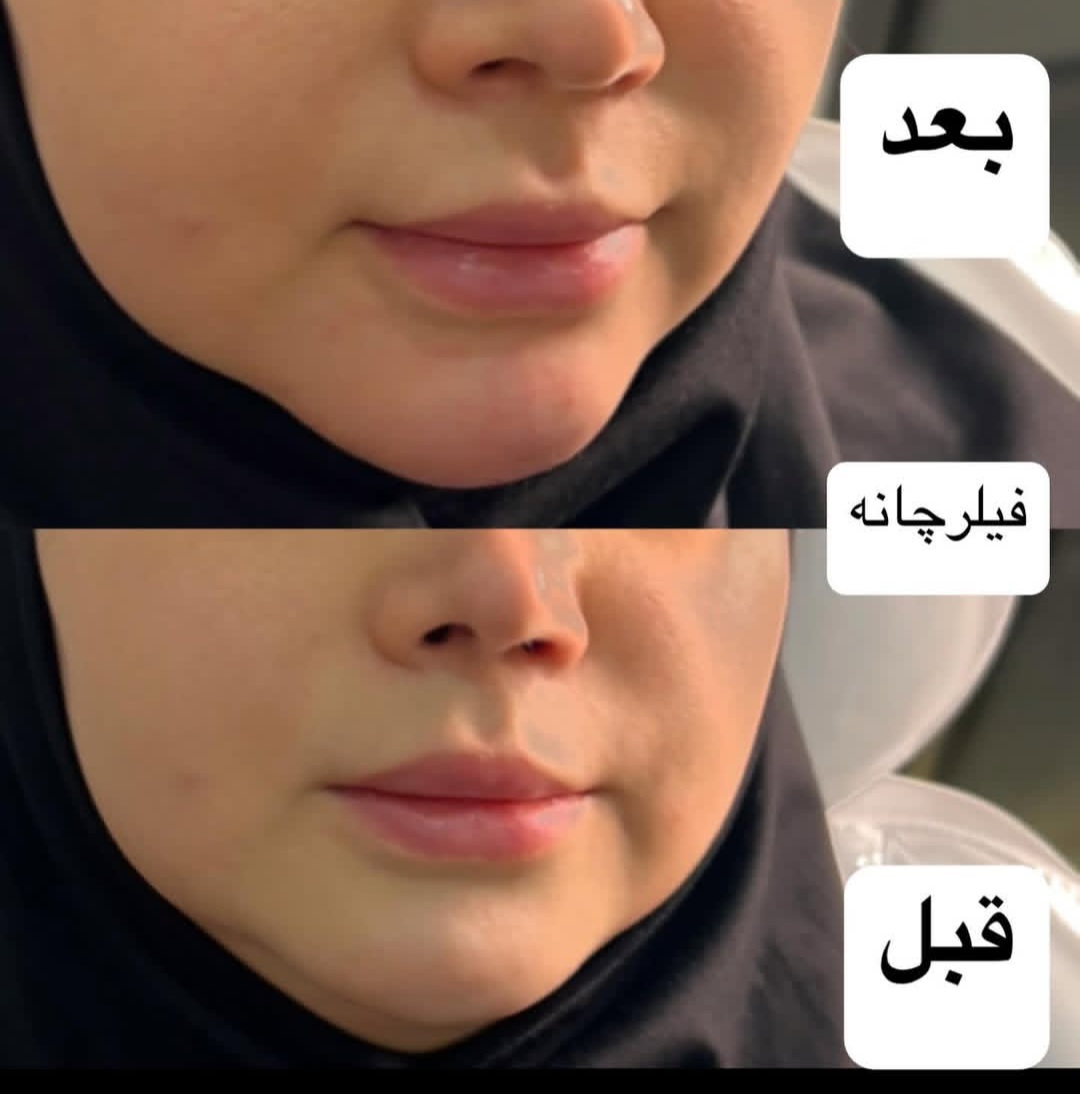 اضافه شده توسط  فرزانه