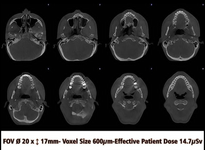 مرکزتخصصی رادیولوژی دهان فک صورت