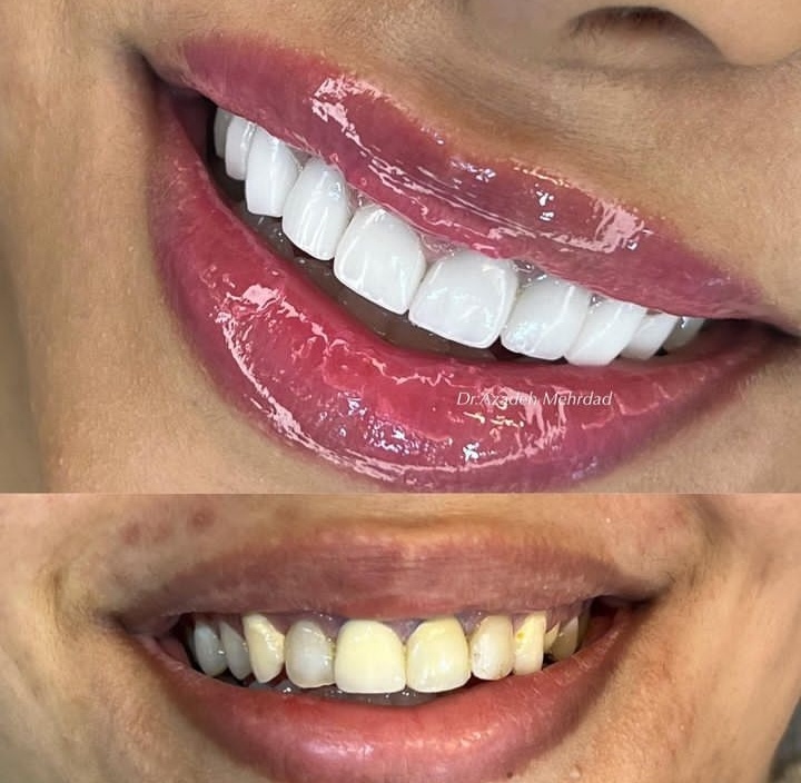 دندانپزشکی دکتر آزاده مهرداد