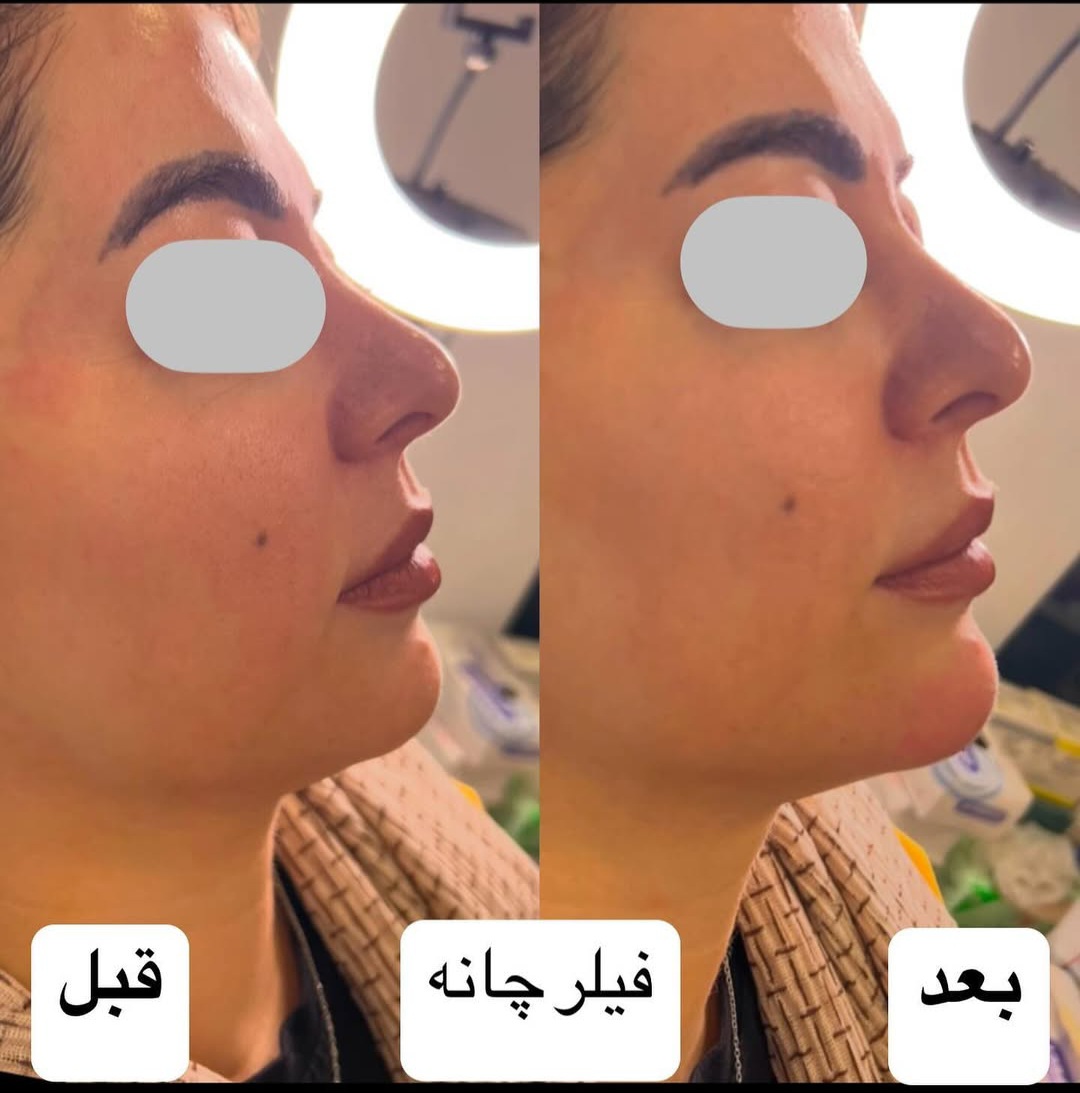 اضافه شده توسط  فرزانه