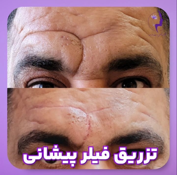 اضافه شده توسط <br> امیر