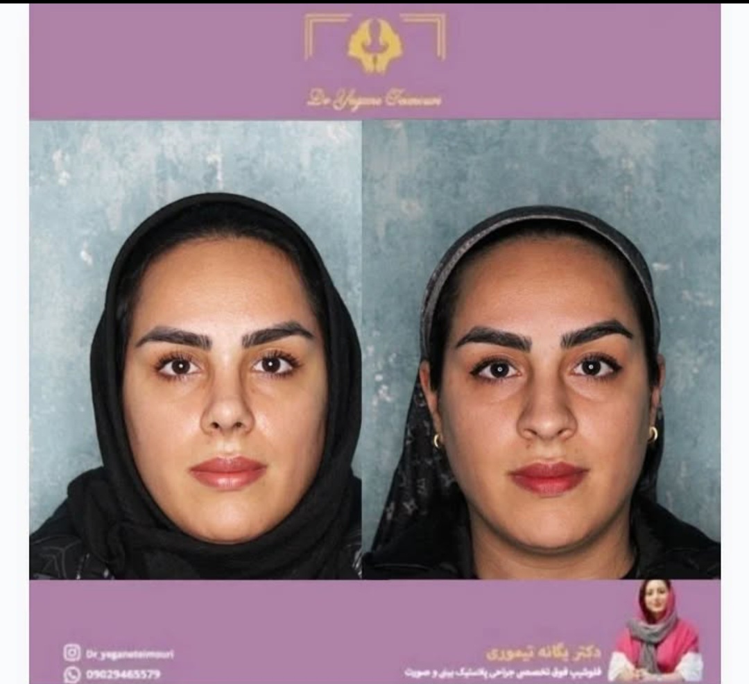 دکتر یگانه تیموری