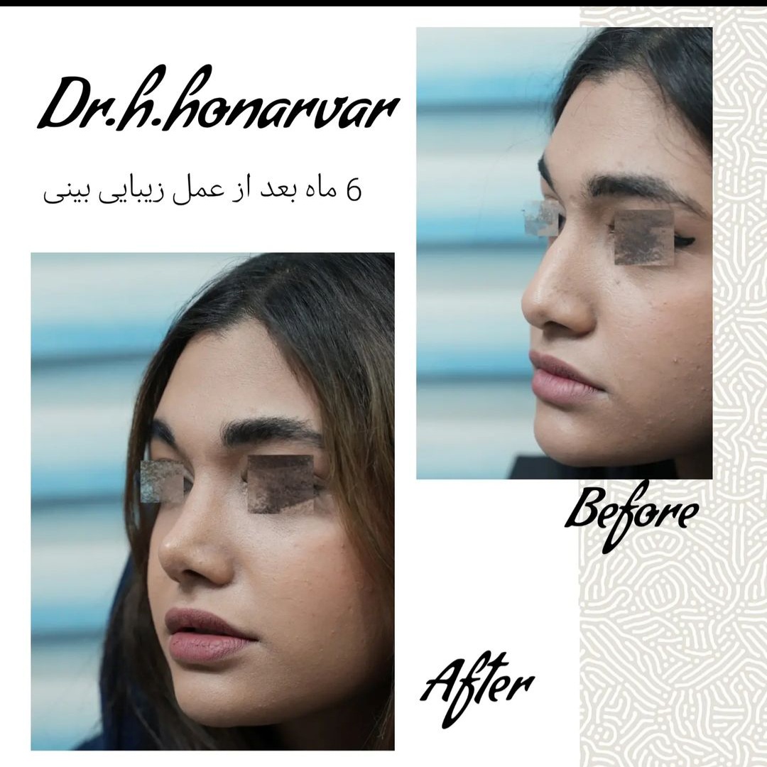 دکتر حسن هنرور