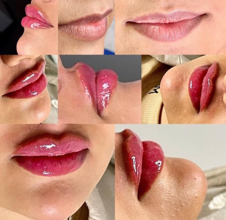 کلینیک پوست مو و زیبایی سلن