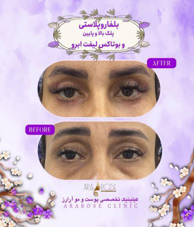 اضافه شده توسط <br> فرزانه