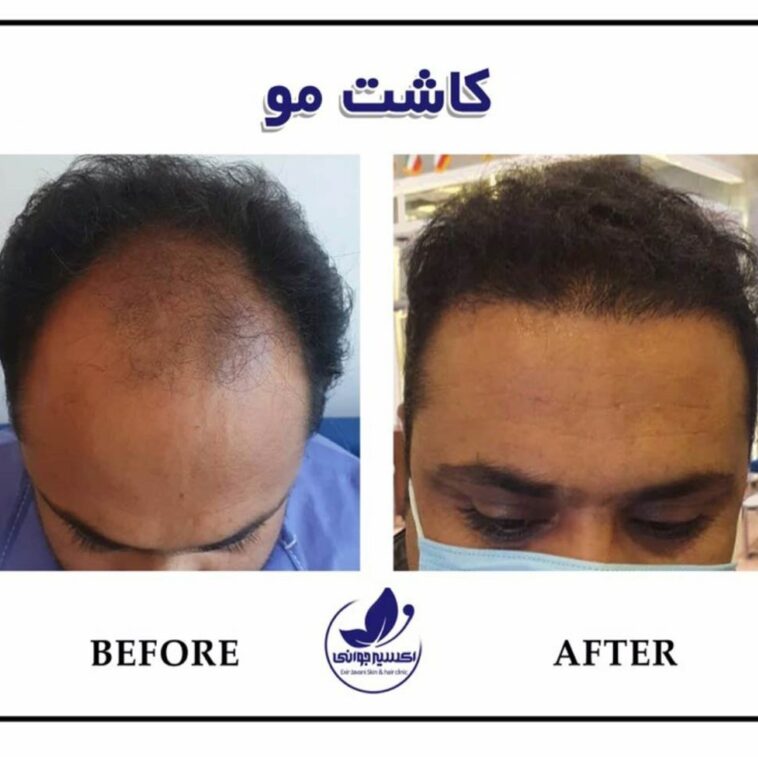 کلینیک پوست و مو اکسیر جوانی