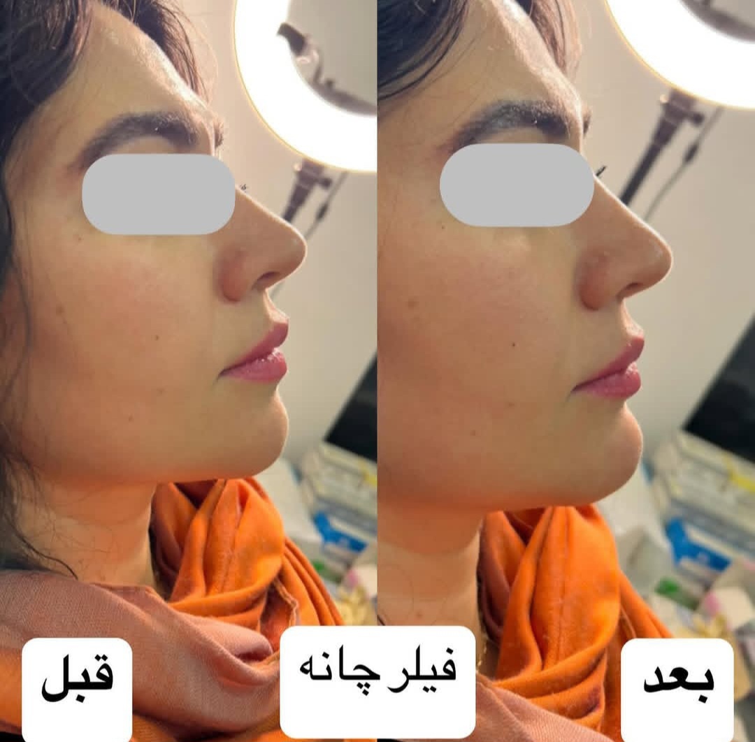 اضافه شده توسط  فرزانه