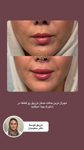 دکتر غزال سعیدیان