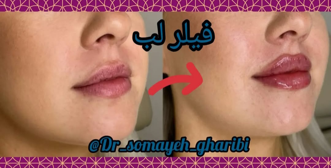 اضافه شده توسط  فرزانه